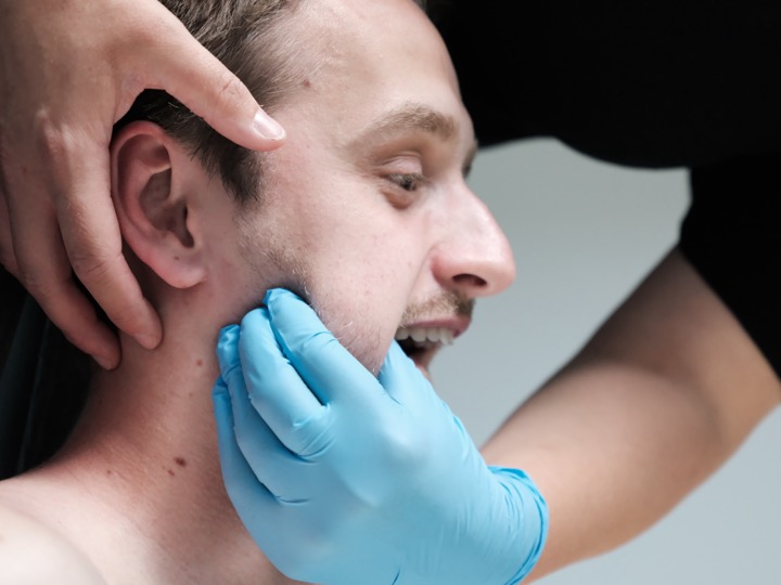 Orofaciale kinesitherapie: behandeling van de kaak